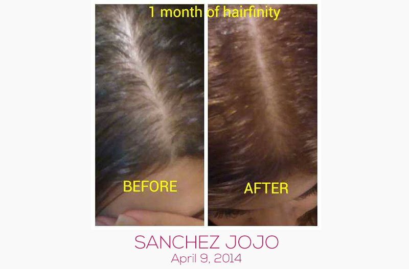 Hairfinity Testimonials of Faster Hair Growth